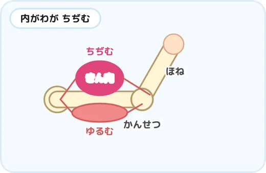 うでを曲げたときの筋肉の図